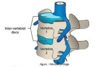 verlebra fig